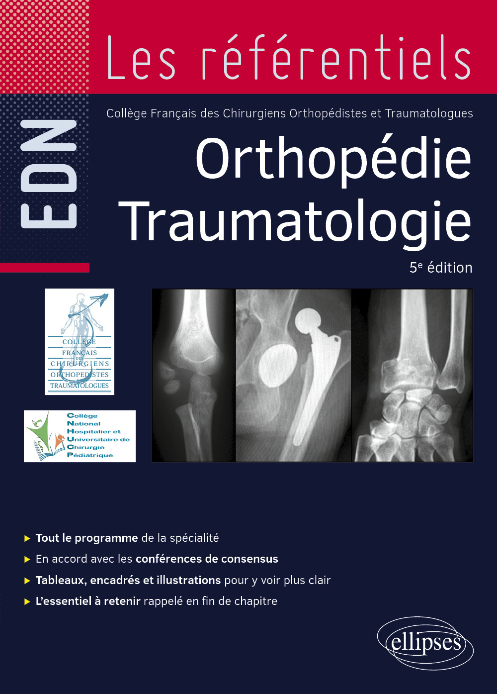 Orthopédie traumatologie (9782340115637-front-cover)