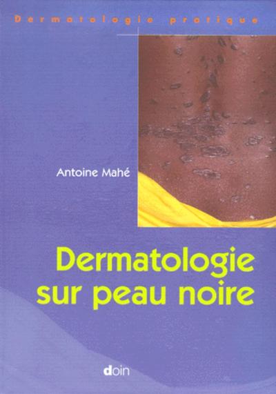 Dermatologie sur peau noire (9782704010837-front-cover)