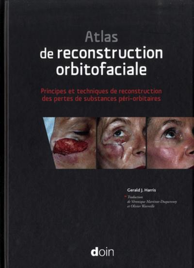 Atlas de reconstruction orbitofaciale, Principes et techniques de reconstruction des pertes de substances péri-orbitaires. (9782704013098-front-cover)
