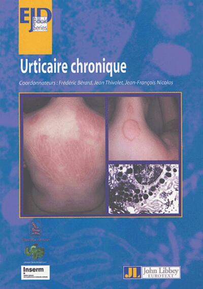 Urticaire Chronique (9782742005321-front-cover)