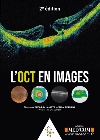 L oct en images. 2° ed (9782354032678-front-cover)