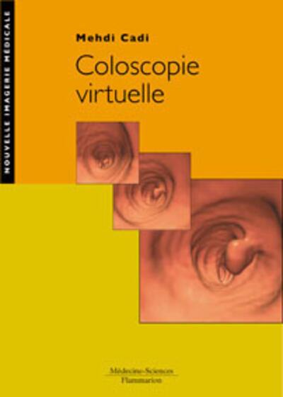 Coloscopie virtuelle (9782257000682-front-cover)