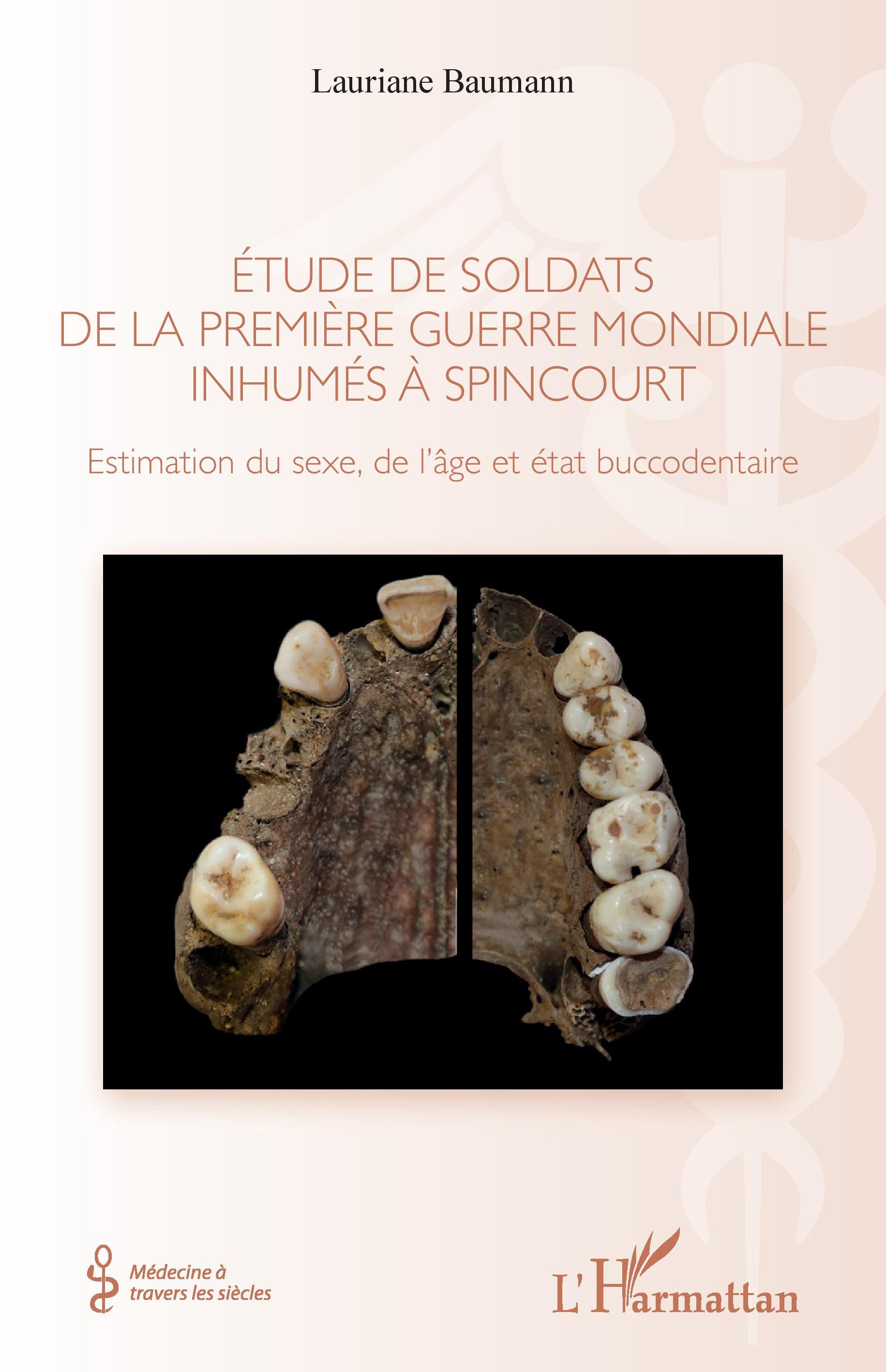 Étude de soldats de la première guerre mondiale inhumés à Spincourt, Estimation du sexe, de l'âge et état buccodentaire (9782343233253-front-cover)