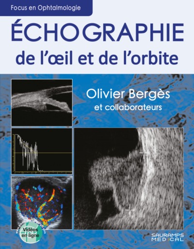 ECHOGRAPHIE DE L OIEL ET DE L ORBITE (9791030303209-front-cover)