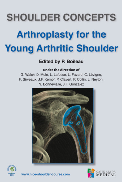 SHOULDER CONCEPTS ARTHROPLASTY FOR THE YOUNG ARTHRITIC SHOULDER (9791030301687-front-cover)