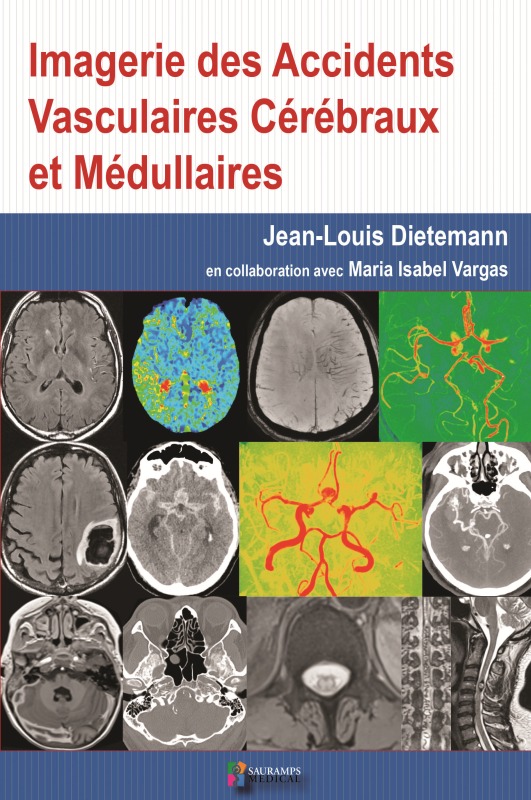 IMAGERIE DES ACCIDENTS VASCULAIRES CEREBRAUX ET MEDULLAIRES (9791030301762-front-cover)