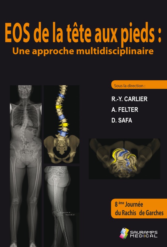 EOS DE LA TETE AUX PIEDS : UNE APPROCHE MULTIDISCIPLINAIRE (9791030302417-front-cover)