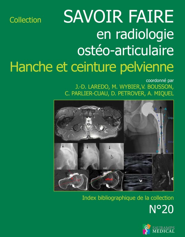 SAVOIR-FAIRE EN RADIOL OSTEO-ARTICUL N°20 HANCHE ET CEINTURE PELVIENNE (9791030301649-front-cover)