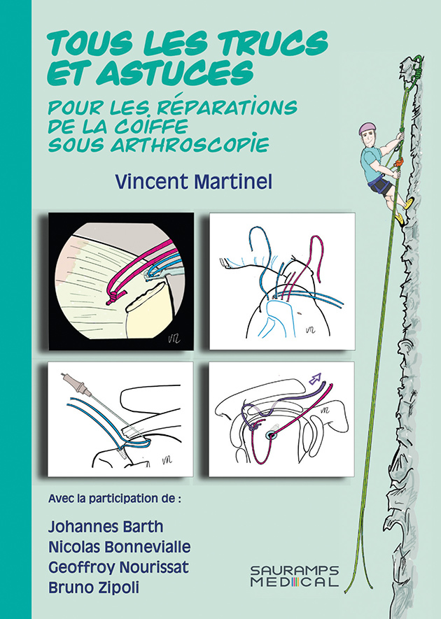 TOUS LES TRUCS ET ASTUCES POUR LES REPARATIONS DE LA COIFFE SOUS ARTHROSCOPIE (9791030303599-front-cover)