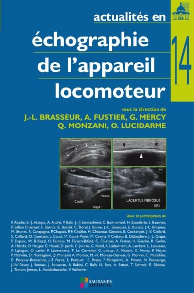 ACTUALITES EN ECHOGRAPIE DE L APPAREIL LOCOMOTEUR T14 (9791030301465-front-cover)