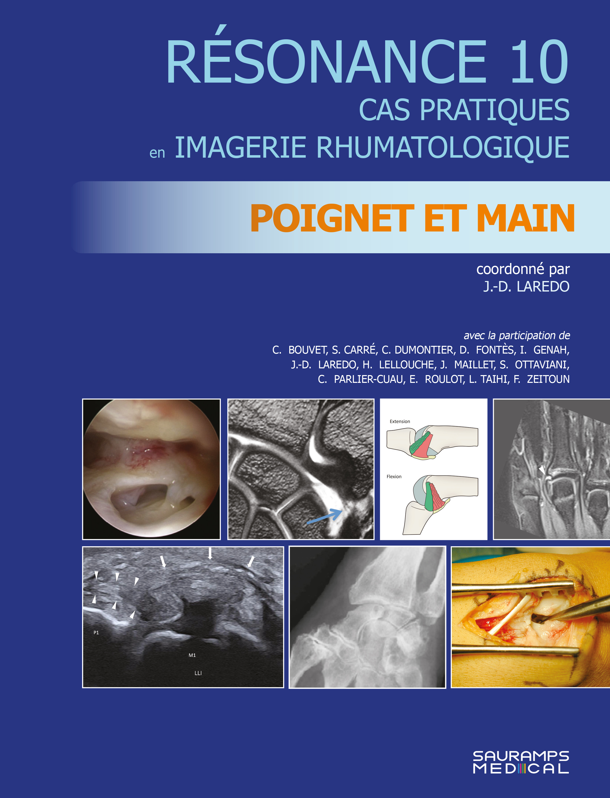 Résonance 10 - Poignet et main, ORTHOPEDIE, RHUMATOLOGIE ET IMAGERIE (9791030304121-front-cover)