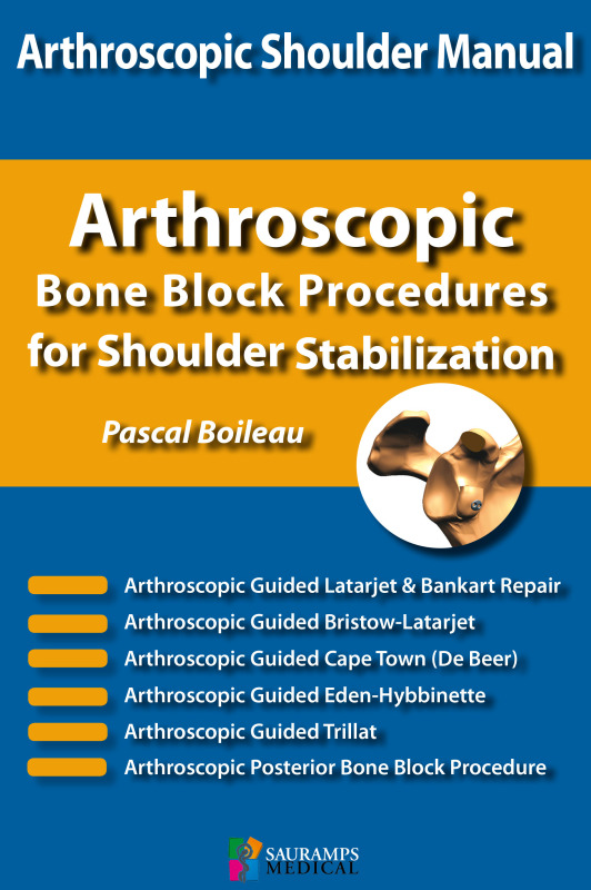 SHOULDER CONCEPTS BON BLOCK PROCEDURES FOR SHOULDER STABILIZATION (9791030301663-front-cover)