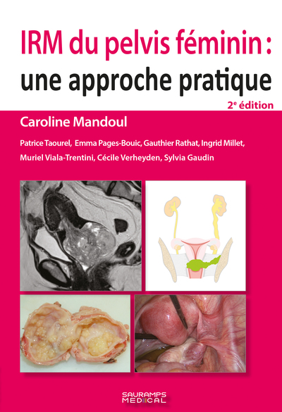 IRM du pelvis féminin 2e ED, Une approche pratique (9791030303551-front-cover)