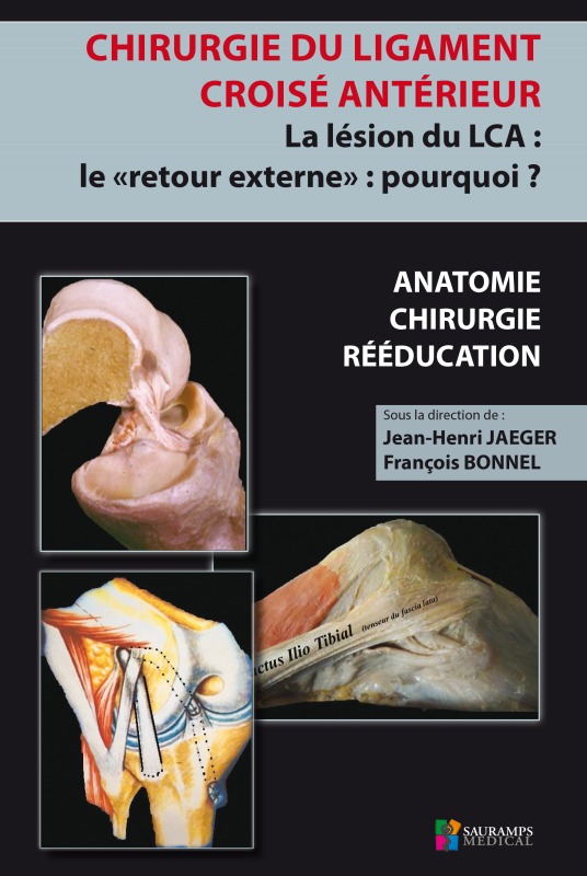 Chirurgie du ligament croisé antérieur du genou la lésion du LCA, le retour externe (9791030301199-front-cover)