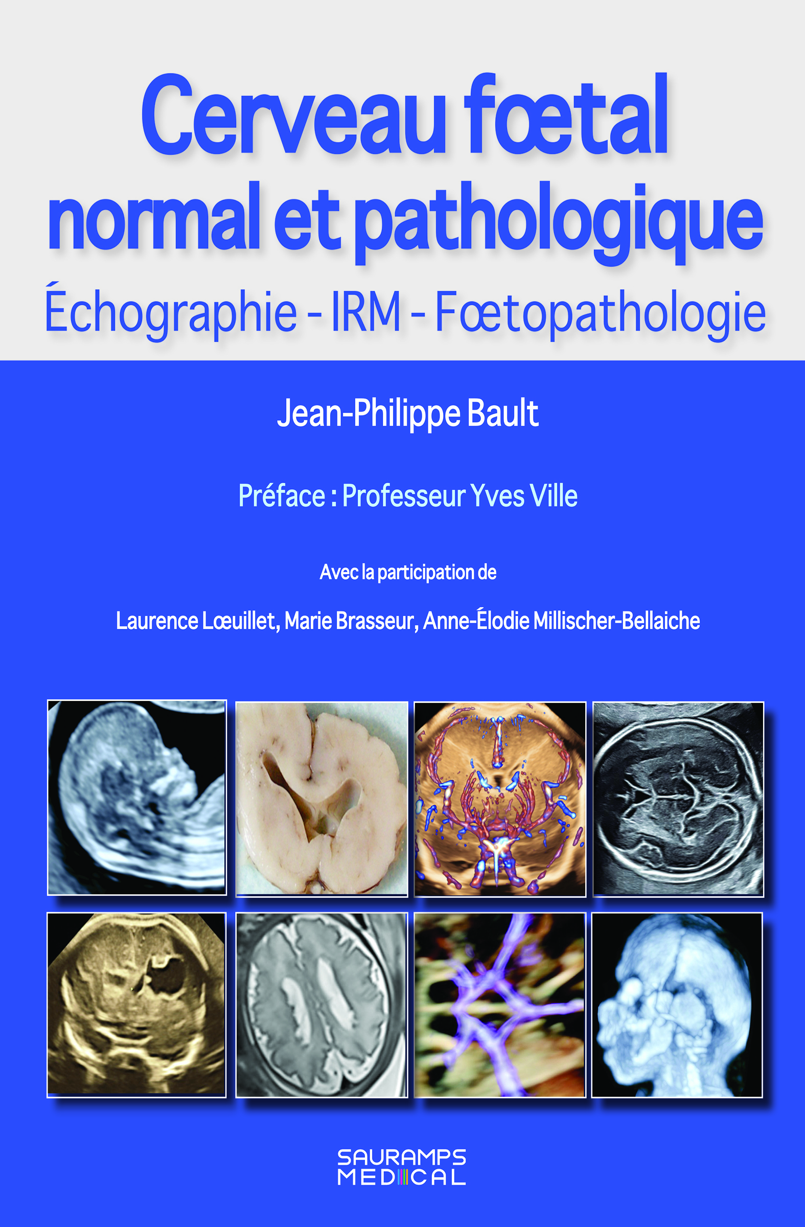 Cerveau foetal normal et pathologique -Echographie, IRM, Foetopathologie (9791030304978-front-cover)