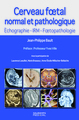 Cerveau foetal normal et pathologique -Echographie, IRM, Foetopathologie (9791030304978-front-cover)