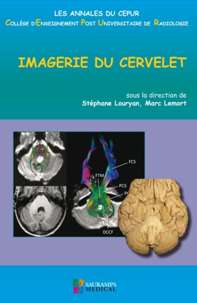 IMAGERIE DU CERVELET (9791030301274-front-cover)