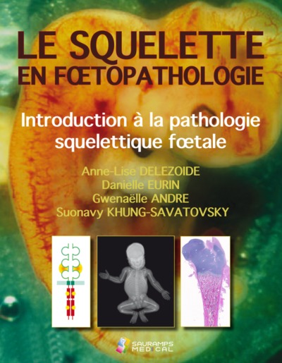 LE SQUELETTE EN FOETOPATHOLOGIE. INTR.A LA PATHOLOGIE SQUELETTIQUE FOETALE (9791030302516-front-cover)