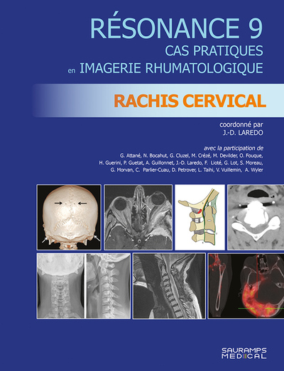 RESONANCE 9. RACHIS CERVICAL, CAS PRATIQUES EN IMAGERIE RHUMATOLOGIQUE (9791030303674-front-cover)