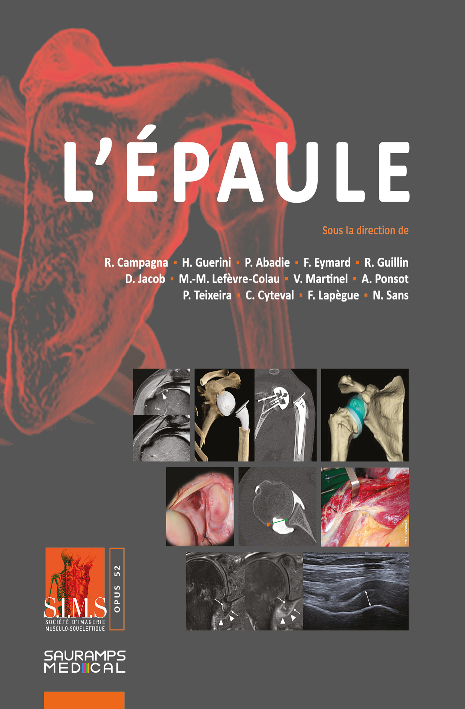 L'épaule - SIMS 2026 (9791030305210-front-cover)