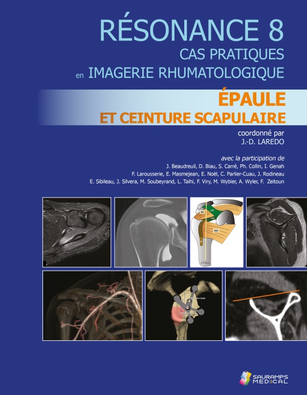 RESONANCE 8 - EPAULE ET CEINTURE SCRAPULAIRE, CA PRATIQUE IMAGERIE RHUMATOLOGIQUE (9791030303162-front-cover)