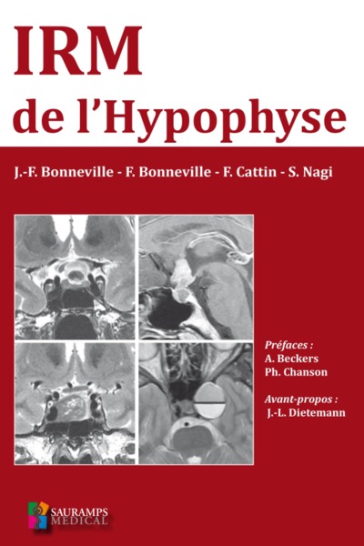 IRM DE L HYPOPHYSE (9791030301281-front-cover)