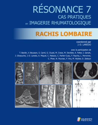 RESONANCE 7 - RACHIS LOMBAIRE, CAS PRATIQUES  IMAGERIE RHUMATOLOGIQUE (9791030302769-front-cover)