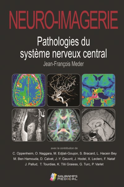 NEURO-IMAGERIE. PATHOLOGIES DU SYSTEME NERVEUX CENTRAL 2ED (9791030303070-front-cover)