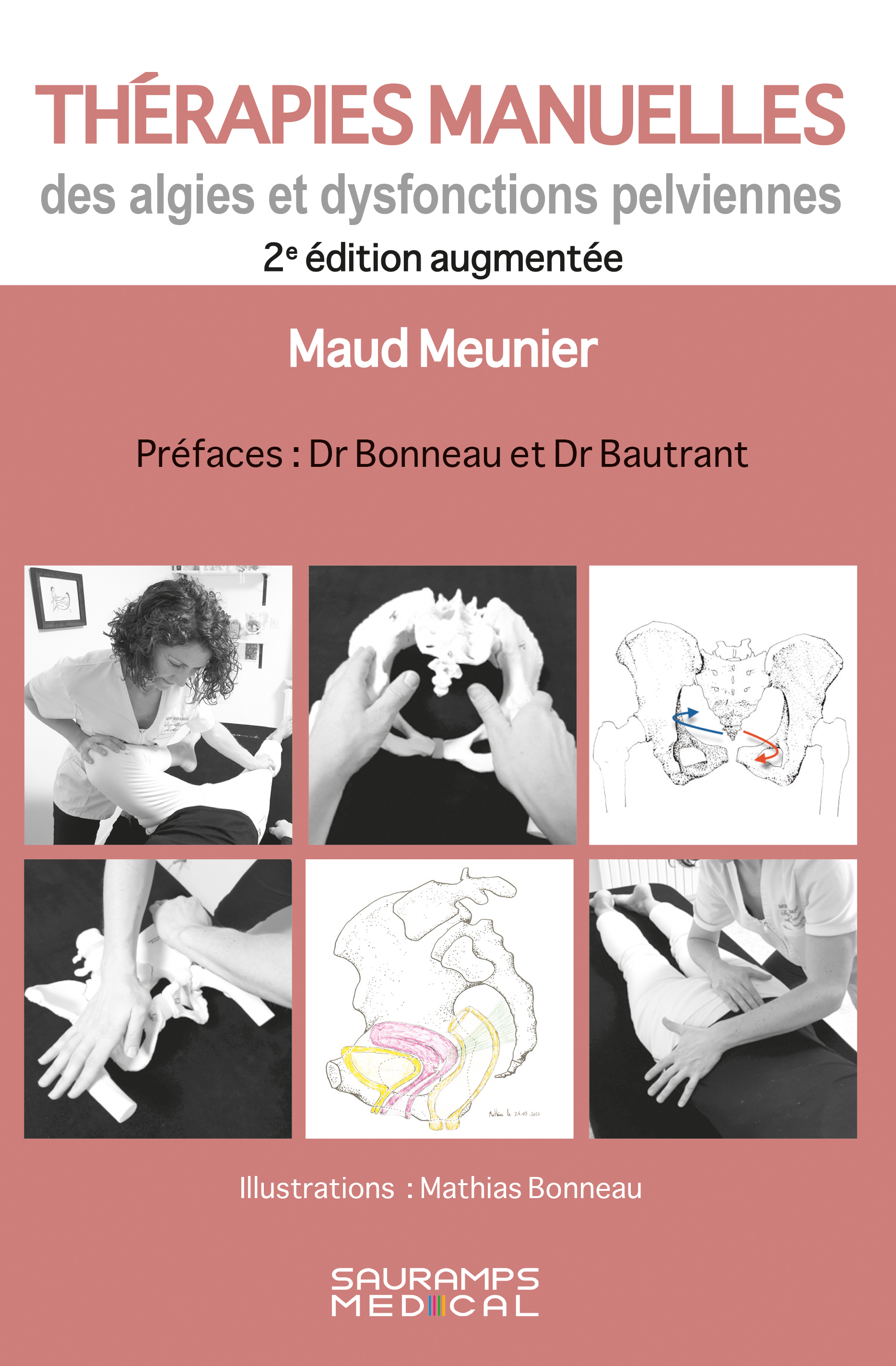 Thérapies manuelles des algies et dysfonctions pelviennes 2ed (9791030305166-front-cover)