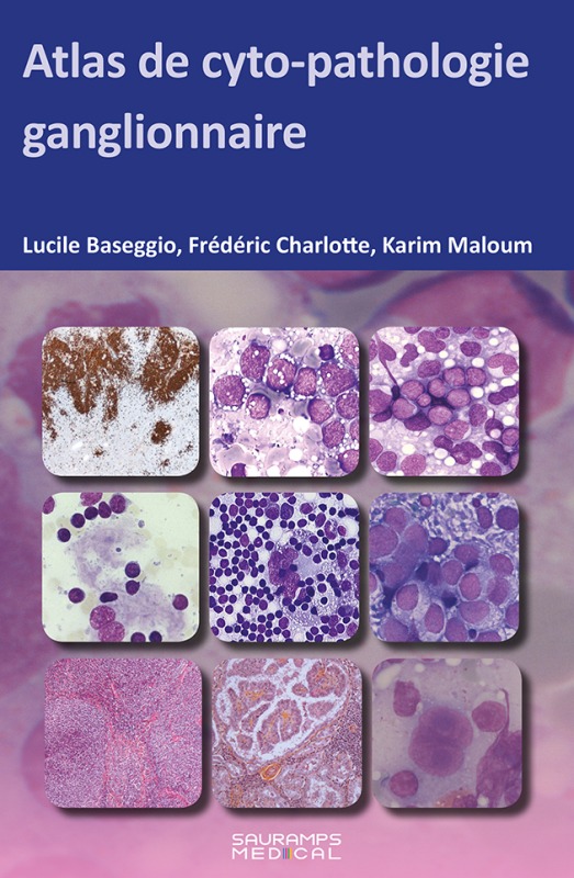 ATLAS DE CYTOPATHOLOGIE GANGLIONNAIRE (9791030303353-front-cover)