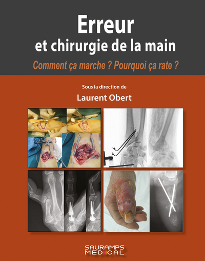 Erreur et chirurgie de la main (9791030305043-front-cover)