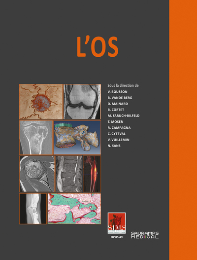 L'os - SIMS (9791030304039-front-cover)