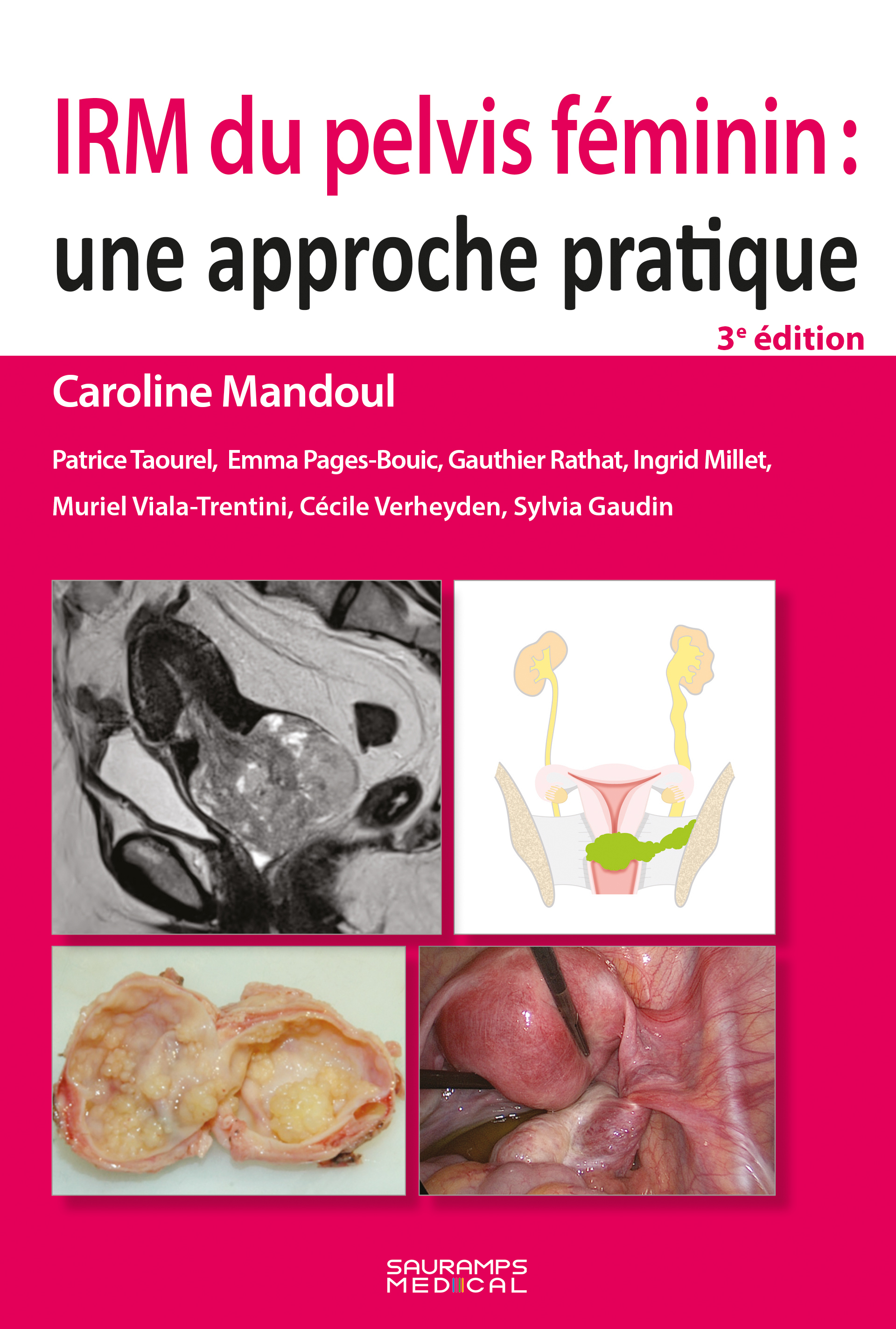 IRM du pelvis féminin : une approche pratique 3e ed (9791030305173-front-cover)