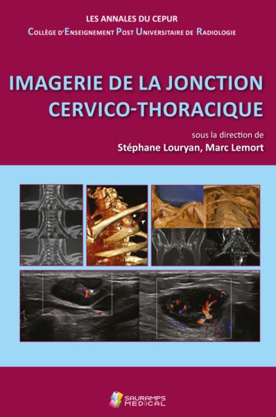 IMAGERIE DE LA JONCTION CERVICO-THORACIQUE, ANNALES DU CEPUR- COLL ENSEIGNEMENT POST-UNIVERSITAIRE DE RADIOLOGIE (9791030303179-front-cover)