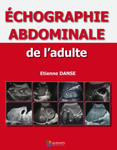 ECHOGRAPHIE ABDOMINALE DE L ADULTE (9791030301298-front-cover)