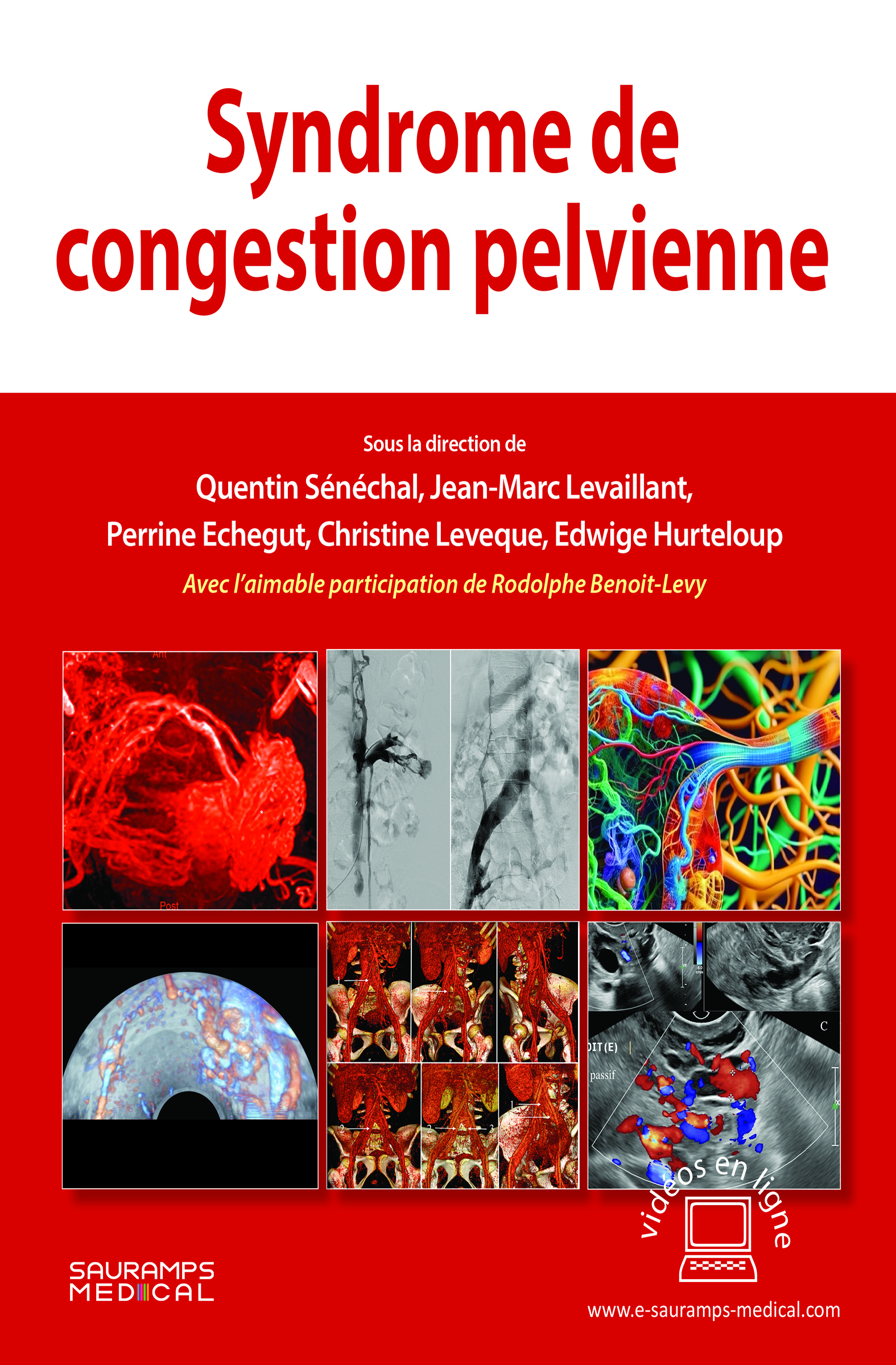 Syndrome de congestion pelvienne (9791030304787-front-cover)