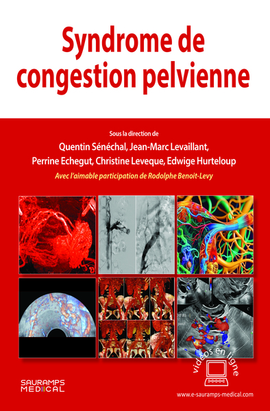 Syndrome de congestion pelvienne (9791030304787-front-cover)
