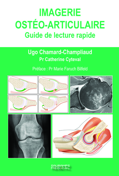 IMAGERIE OSTEO-ARTICULAIRE, Guide de lecture pratique (9791030303537-front-cover)