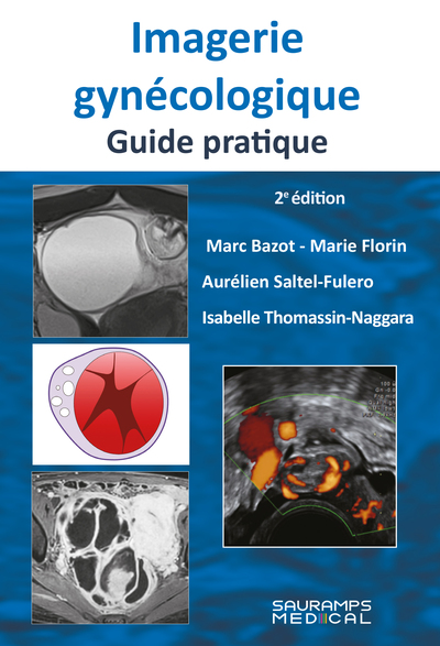 Imagerie gynécologique. Guide pratique 2ed (9791030304091-front-cover)