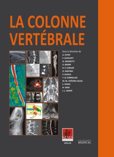 LA COLONNE VERTEBRALE (9791030301700-front-cover)