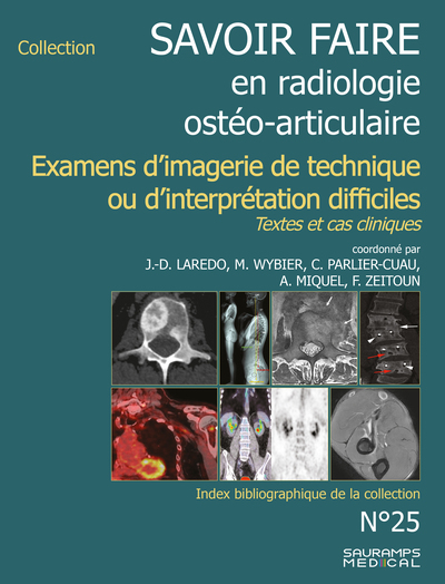 Savoir-faire en radiologie ostéoarticulaire n°25, Examens d'imagerie de technique ou d'interprétation difficiles (9791030303919-front-cover)