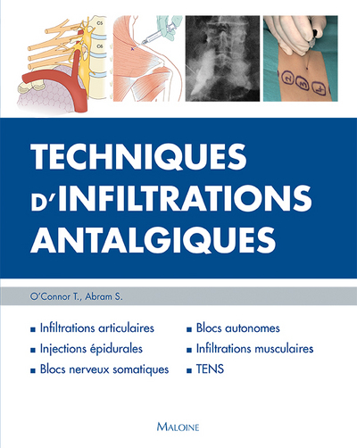 TECHNIQUES D'INFILTRATIONS ANTALGIQUES (9782224034443-front-cover)
