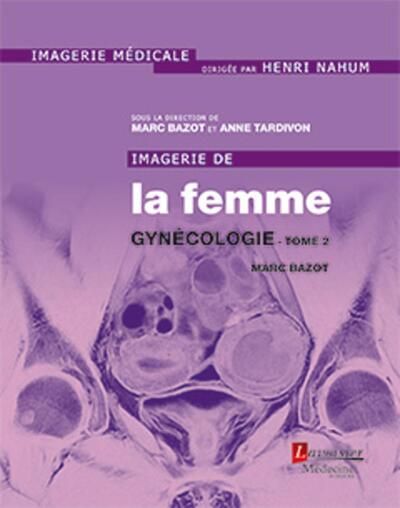 Imagerie de la femme : Gynécologie - Tome 2 (9782257206060-front-cover)