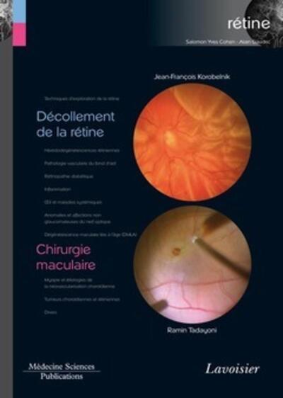 Décollement de la rétine / Chirurgie maculaire (volume 6 - coffret Rétine), (volume 6 - coffret Rétine) (9782257205155-front-cover)