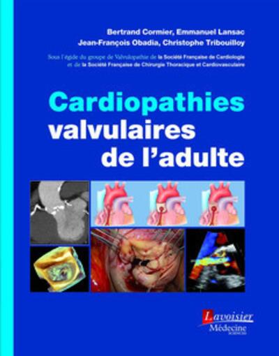 Cardiopathies valvulaires de l'adulte (9782257205964-front-cover)