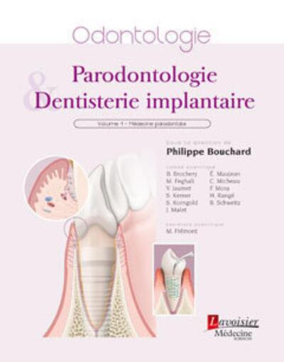 Parodontologie et Dentisterie implantaire. Volume 1 : Médecine parodontale, Volume 1 : Médecine parodontale (9782257205551-front-cover)