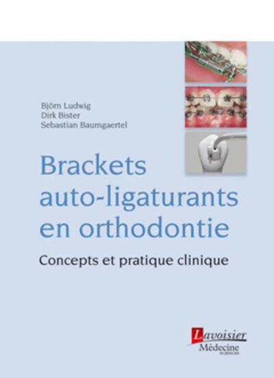 Brackets auto-ligaturants en orthodontie, Concepts et pratique clinique (9782257204257-front-cover)