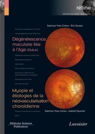 Dégénérescence maculaire liée à l'âge (DMLA) / Myopie et étiologies de la néovascularisation choroïdienne (volume 7 - coffret Ré (9782257205162-front-cover)