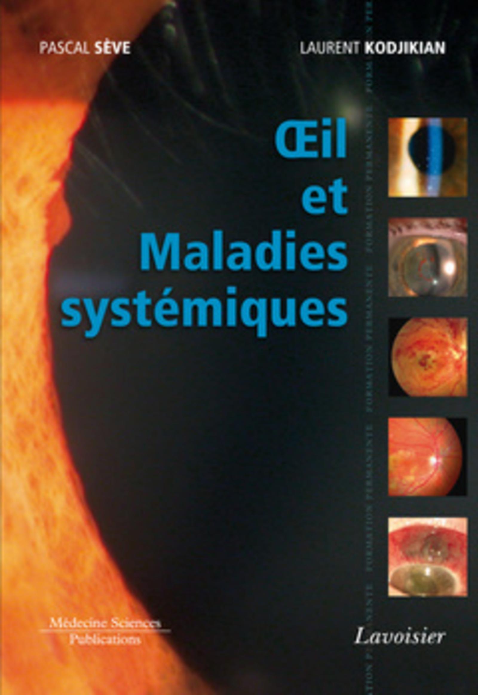 Oeil et Maladies systémiques (9782257205803-front-cover)