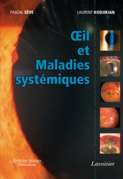 Oeil et Maladies systémiques (9782257205803-front-cover)